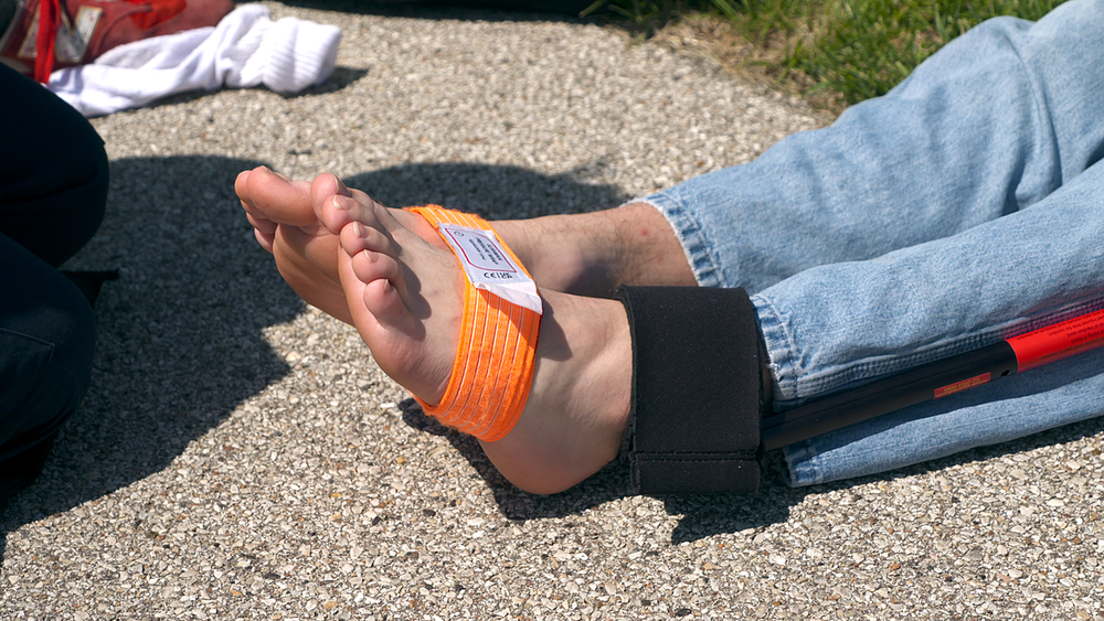 Slishman Traction Splint (STS) - Gen 2