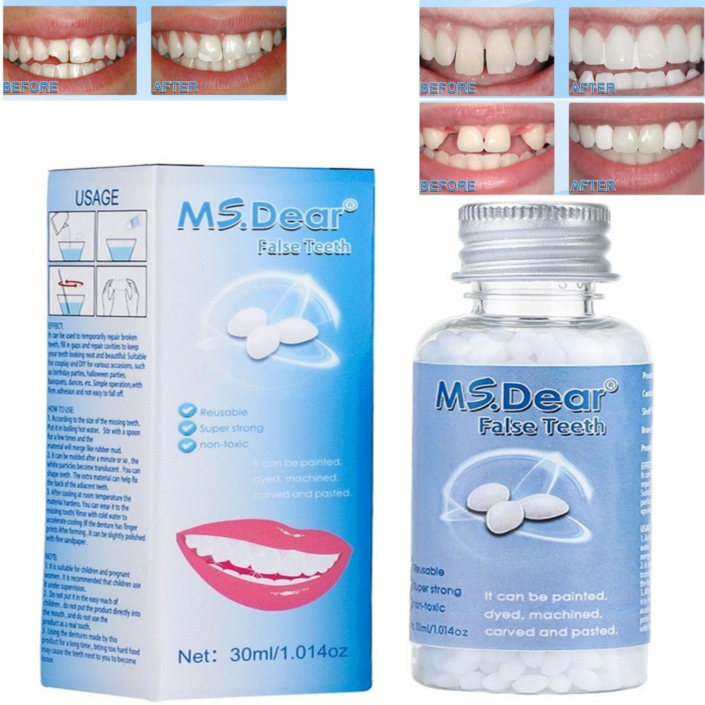 Moldable Teeth Beads Repair Kit - Temporary Fix for Missing, Broken or Gap Teeth
