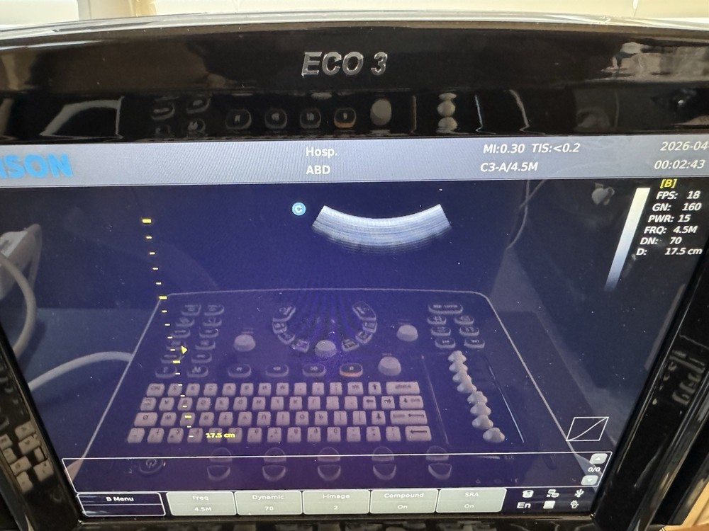 Chison Eco 3 with Convex Abdominal Probe