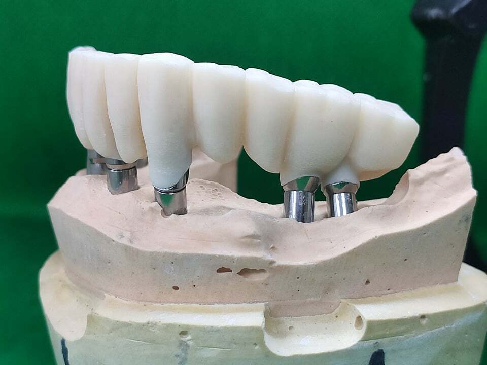 DLP SLA LCD 3d printer temporary teeth resin ..