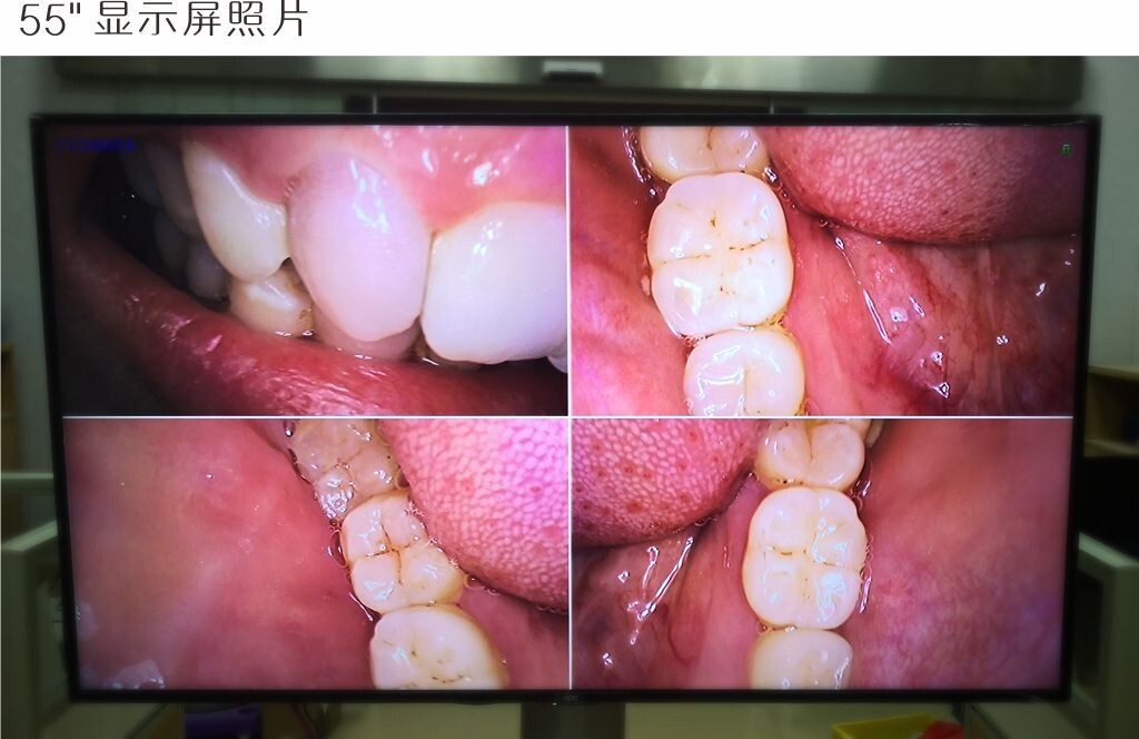 New 1080P Intraoral Camera For Decayed Tooth/Dental Calculas And Plaque MD4000B