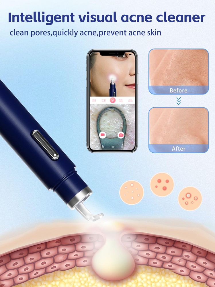 Visual Blackhead Remover Tools with CameraPimple Popper Extractor Tool Kit wi...