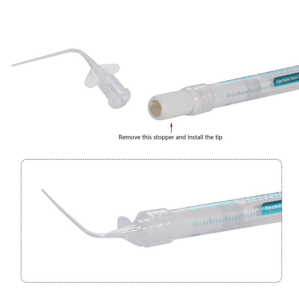 nRoot SP Injectable Root Canal Bioceramic Sealer 1g Syringe with Applicator Tips