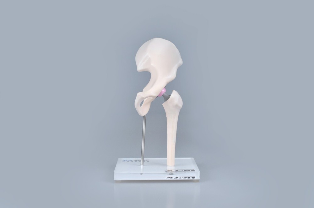 1/3 Artificial Hip Joint Replacement Anatomical Skeleton Demo Display Model
