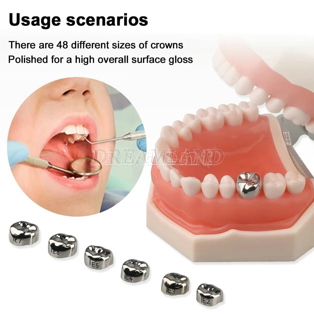 48 ASSORTED PRIMARY MOLAR STAINLESS STEEL CROWNS - COMPLETE KIT