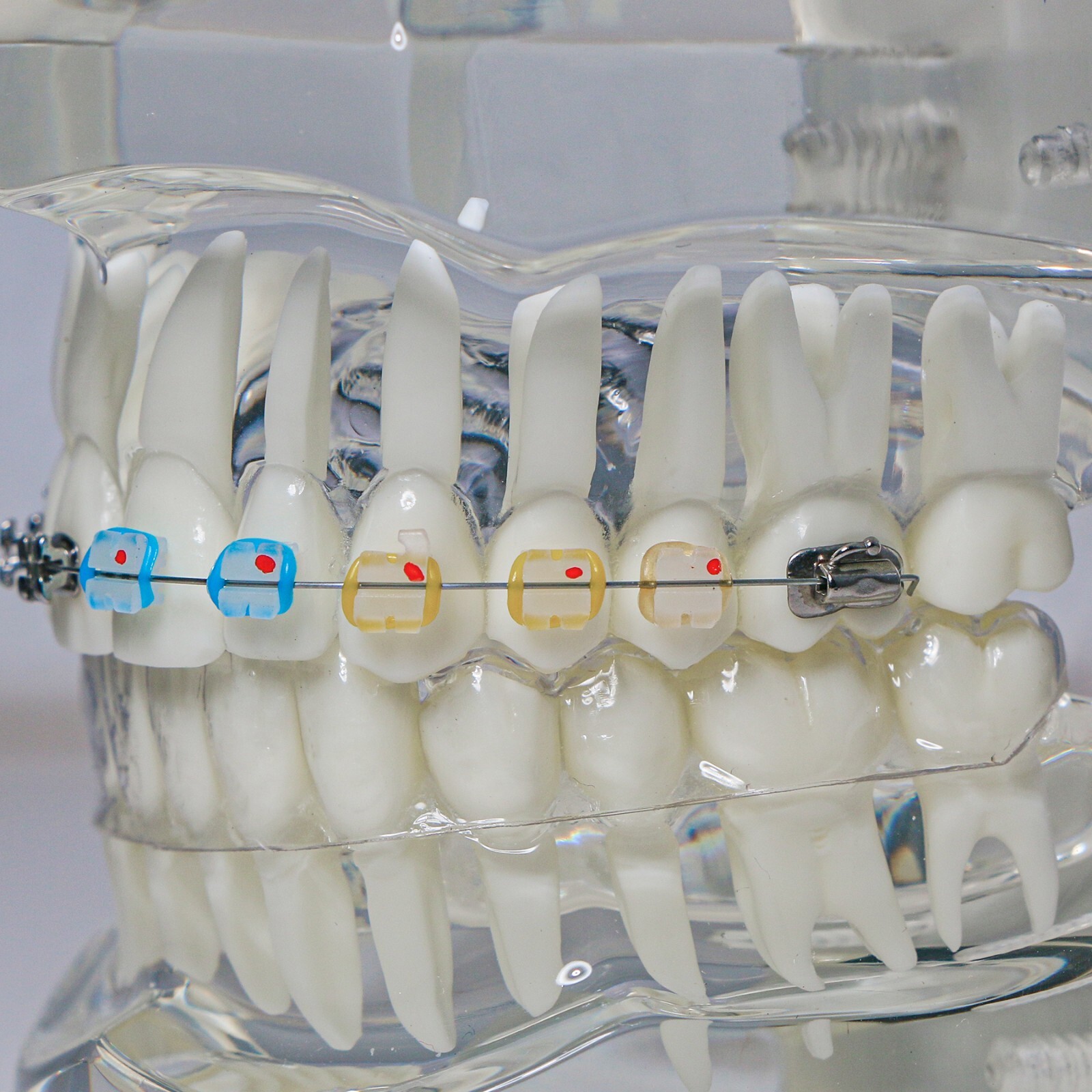 Dental Ortho Teeth Model With Metal Ceramic Brackets Lingual Braces Tube Teach