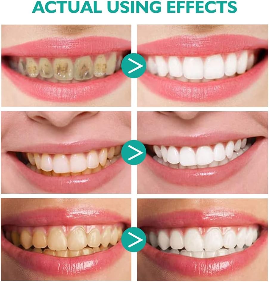 Foam Toothpaste 2PCS,Stain Removal for Sensitive Teeth,Teeth...