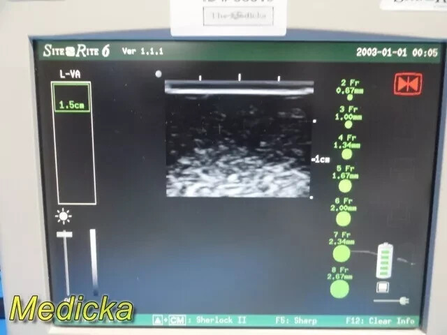 Chison Tech L-VA Linear Array Probe – Vascular Imaging for SR-6 (Tested) ~ 36100