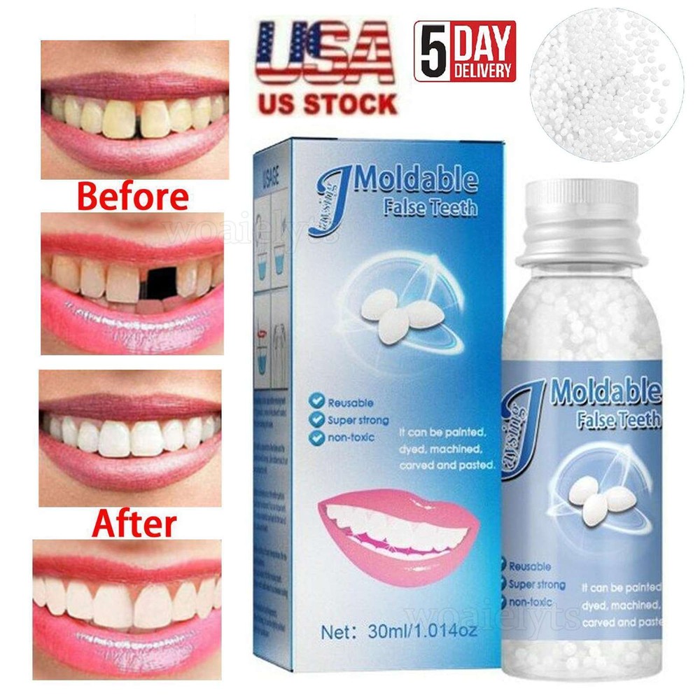 UK Tooth Repair Kit Temporary Teeth Replacement Beads for Missing & Broken Teeth