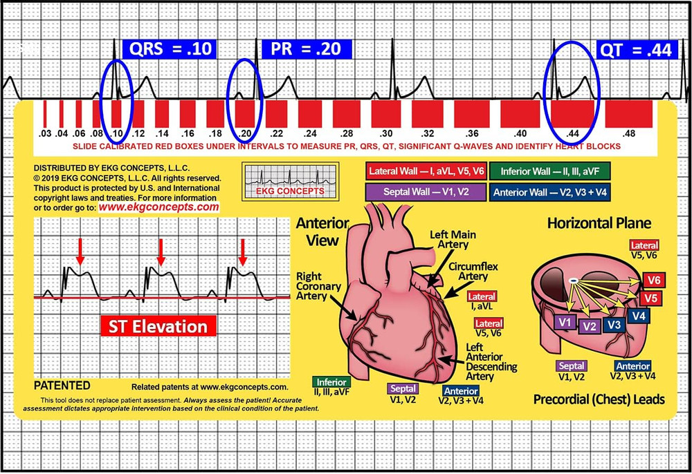 EKG Window: Second Edition