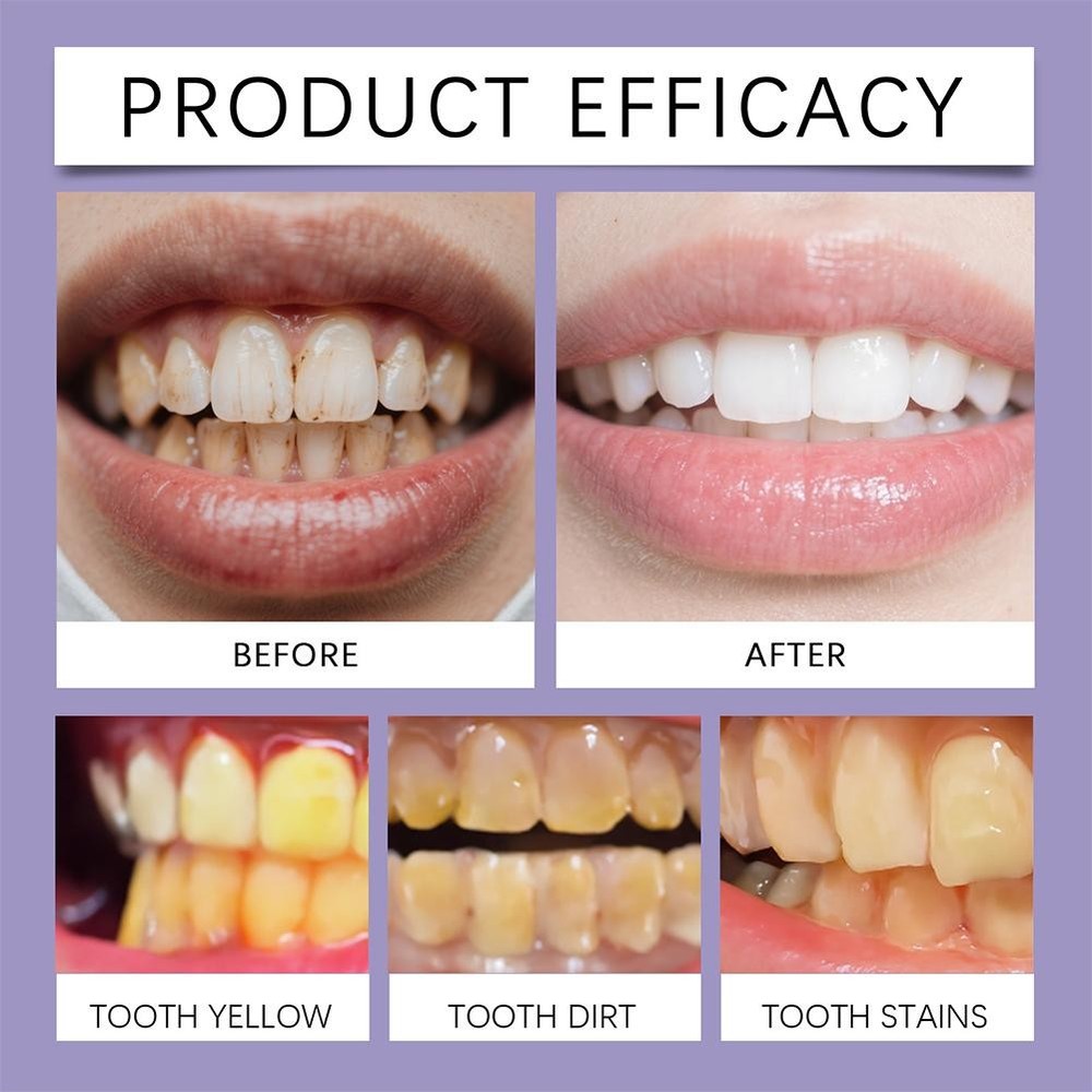 Lysozyme Whitening Toothpaste, 2026 Colour Correcting Purple Toothpaste Hot