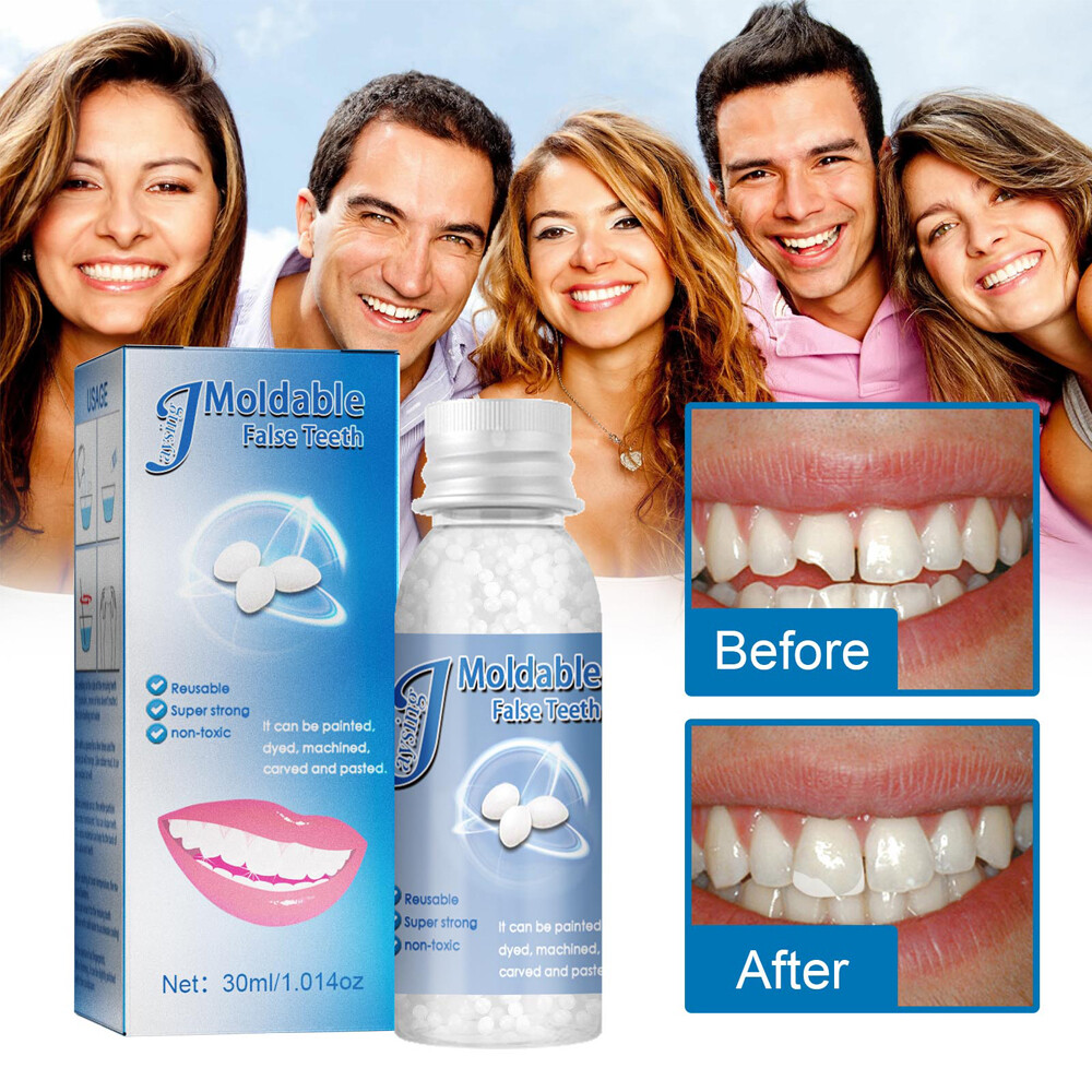 Tooth Repair Granules Temporary Kit Fitting Beads Reusable Moldable False Teeth