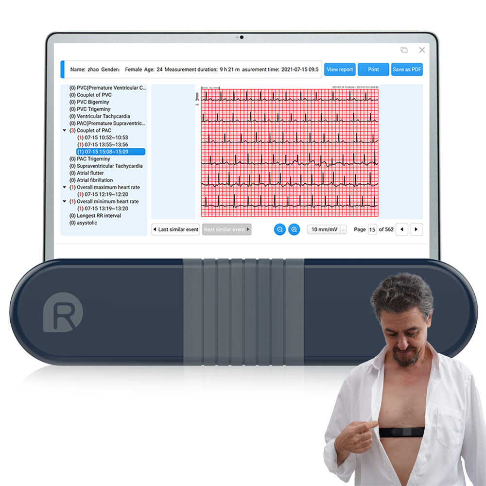 AI Holter Monitor 24 Hrs Chest Strap EKG Monitor with Free AI Analysis PC Report