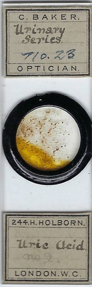 Human Urinary Series Uric Acid Pathology Microscope Slide by C. Baker