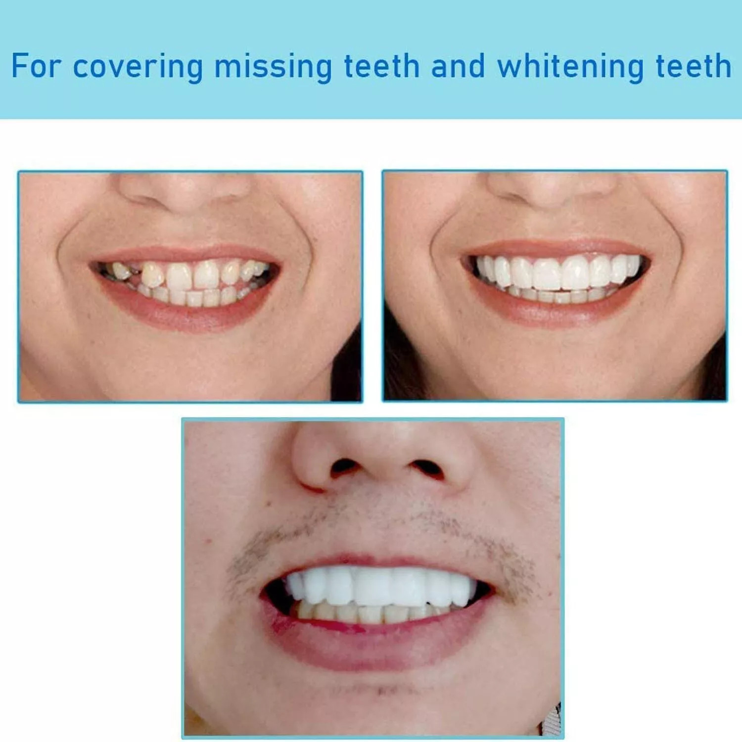 Smile Snap On Upper + Lower False Teeth Dental Veneers Denture Tooth Cover Set