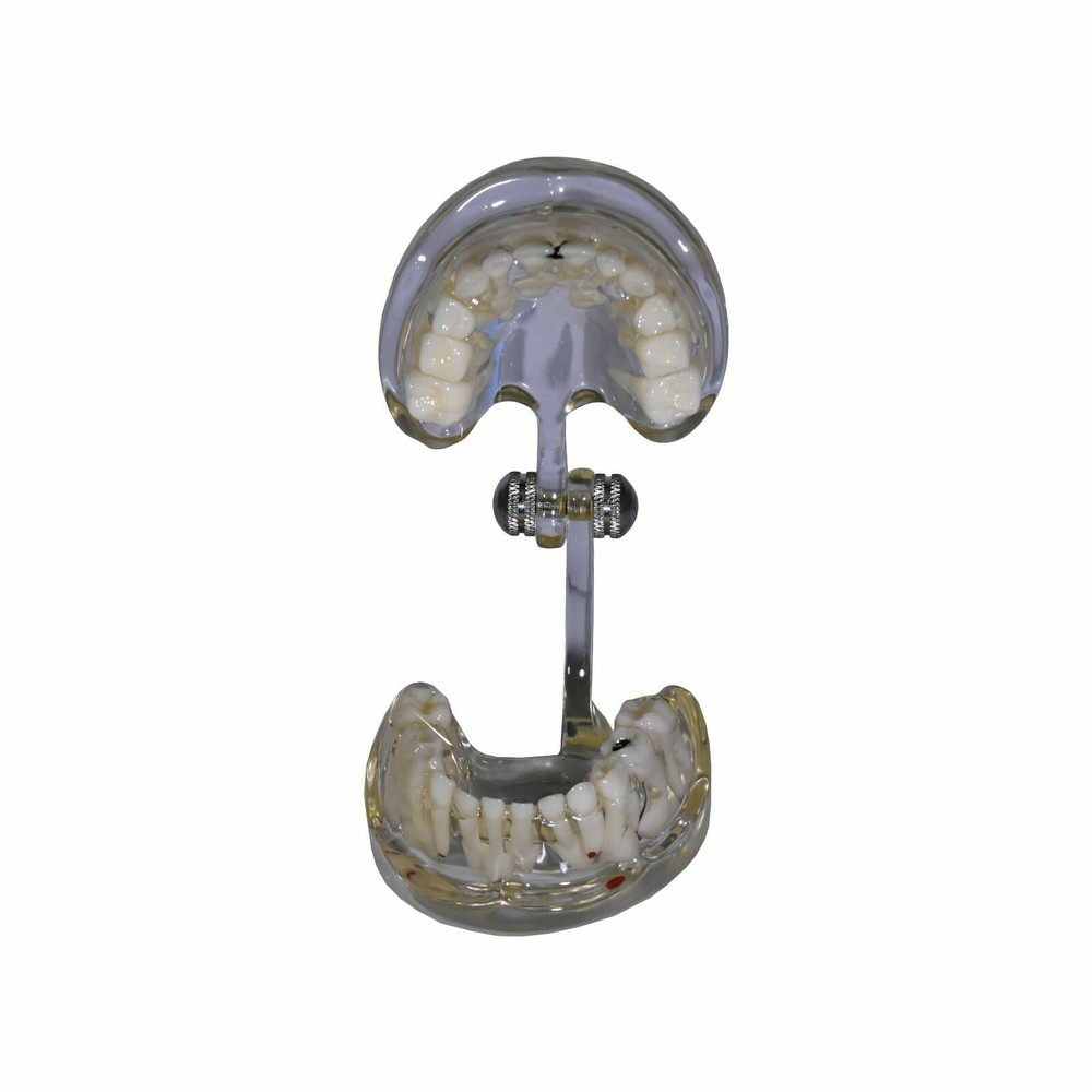 Redland Model Dental Demonstration Teeth Educational Model -FDA