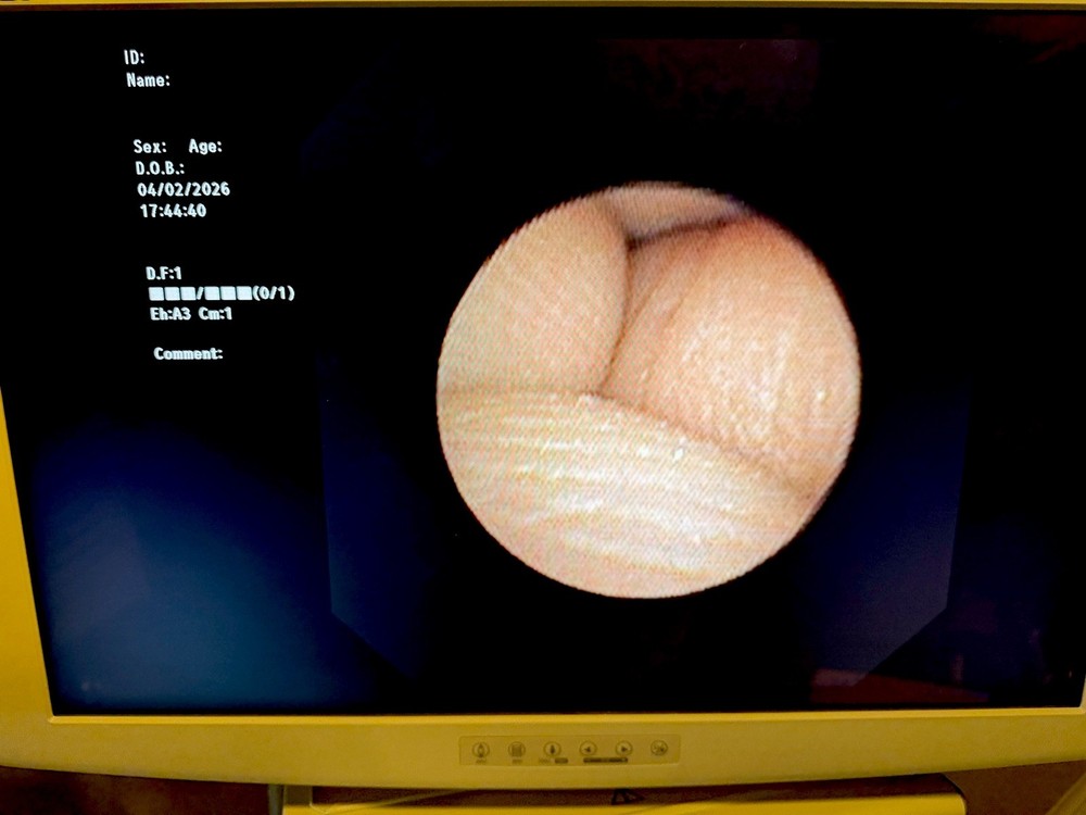 BF-MP190F Endoscope /Video Scope