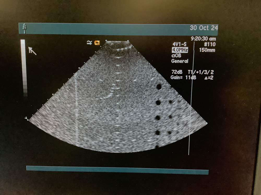 2017 Acuson 4V1 for Sequoia Linear Array Ultrasound Probe