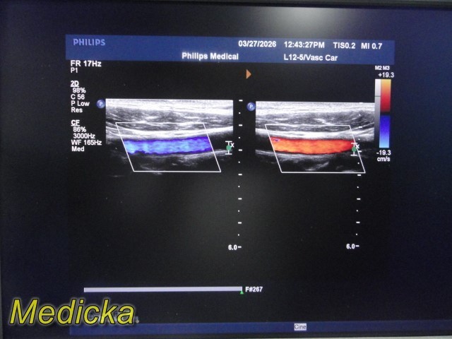 Philips L12-5 Linear Array Ultrasound Transducer *TESTED & WORKING* ~ 39679
