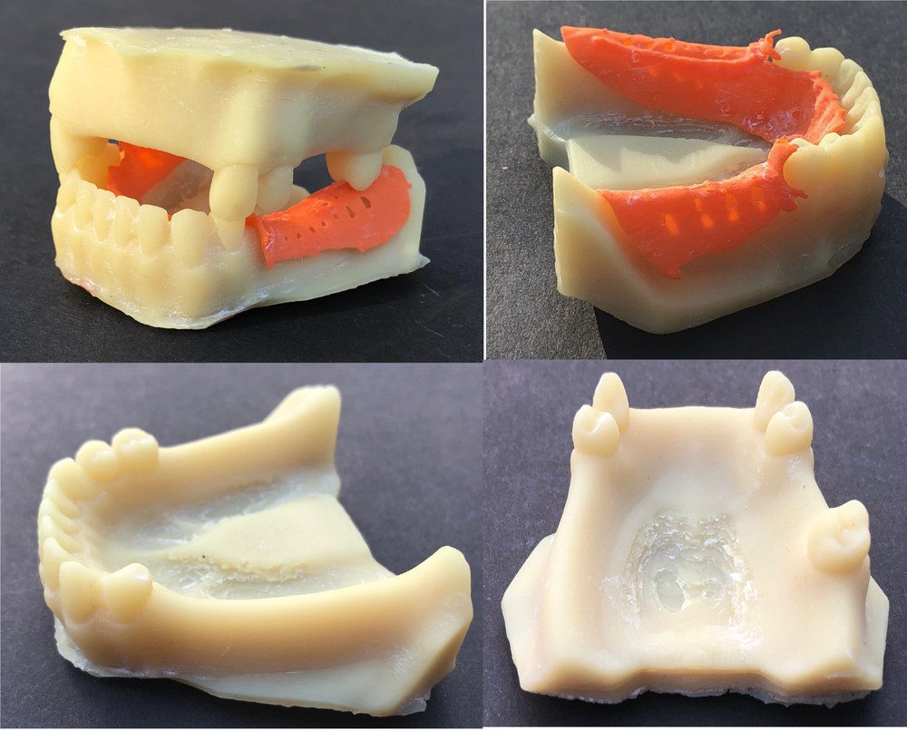ALPHASENSE 3D DENTAL MODEL RESIN (500 ML)