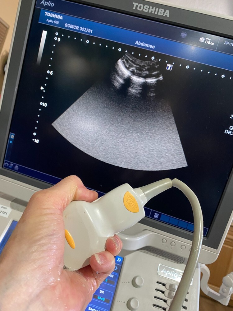 Toshiba Model PVT-674BT Convex Array Transducer