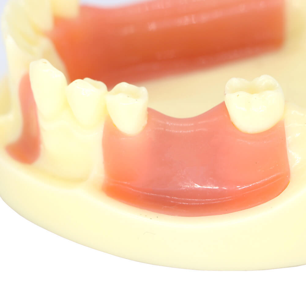 Dental Study Model with Bone Resorption & Missing Teeth for Implant Training