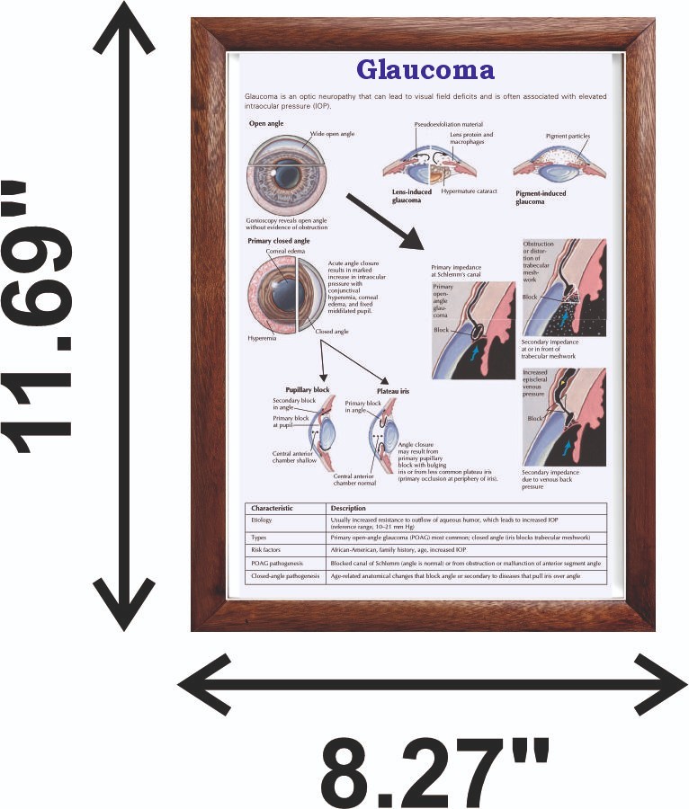 Glaucoma Chart 12x18 inches