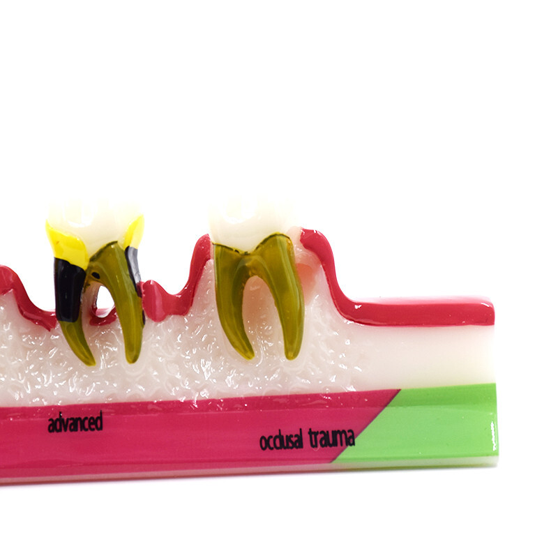 Dental High Quality Assort Dentoform Pathological Study Periodontal Model Teeth
