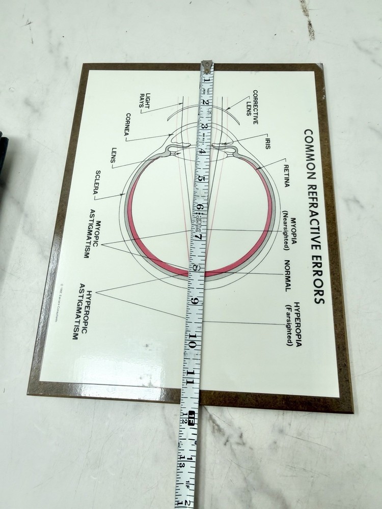 Vintage Optometry Eye Chart Board Common Refractive Errors Teaching Display