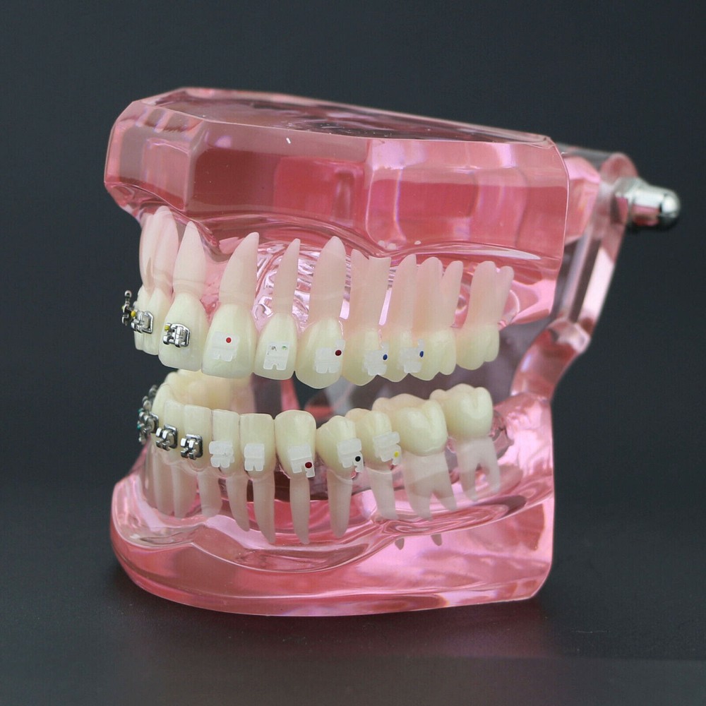 Dental Orthodontic Demonstration Ceramic and Metal Bracket Study Typodont Model
