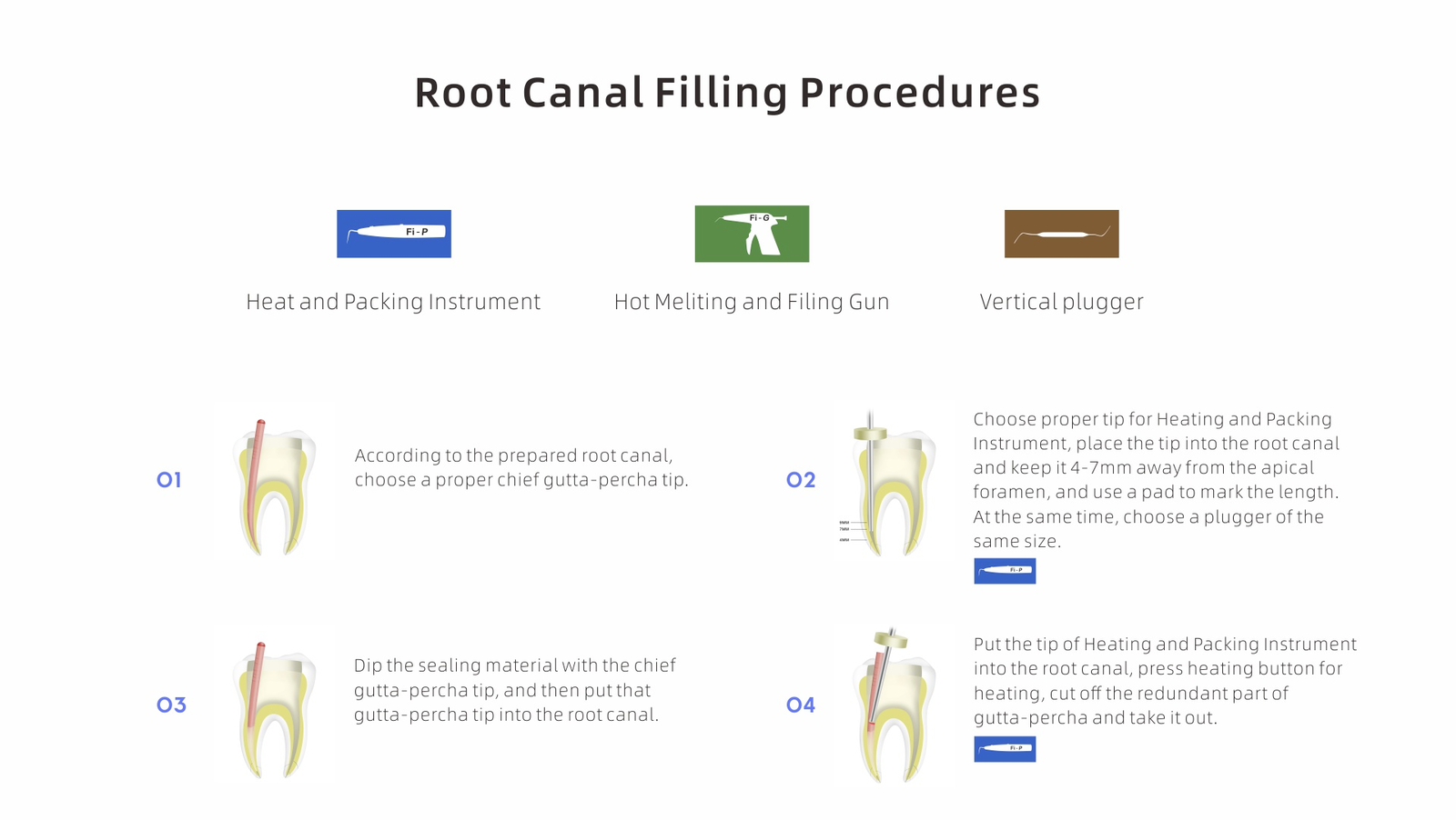 Woodpecker Endo Fi-G Fi-P Cordless Gutta-Percha Obturation System