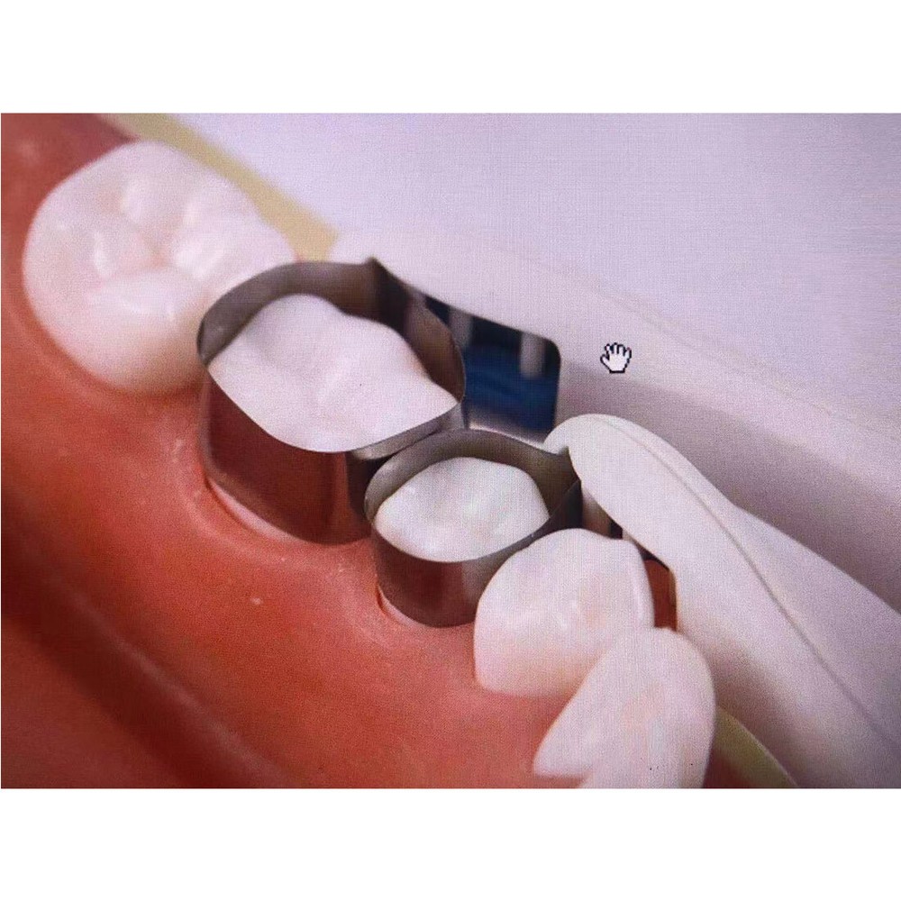 50pcs/pack Dental Pro Matrix Band Adjustable Retainer Matrices System