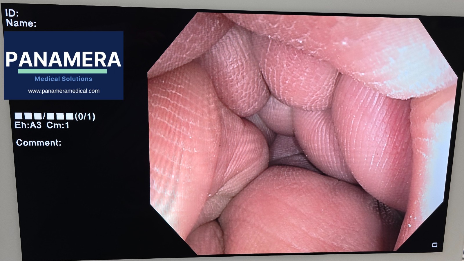 Olympus PCF-H180AL Colonoscope Endoscopy Endoscope - Tested