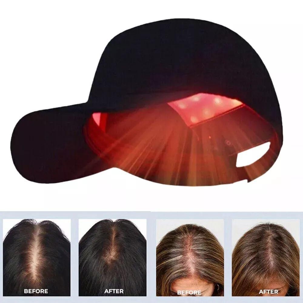 US 650nm Red LED Light Therapy Hat Hair Loss Treatment Cap Hair Growth Regrowth