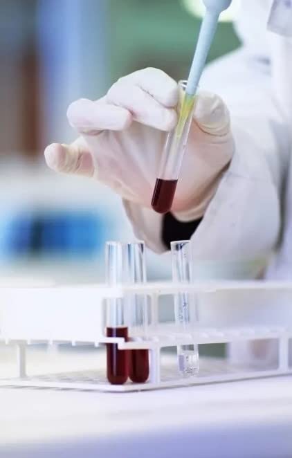 Othmro 20ml 100pcs Plastic Lab Centrifuge Tubes