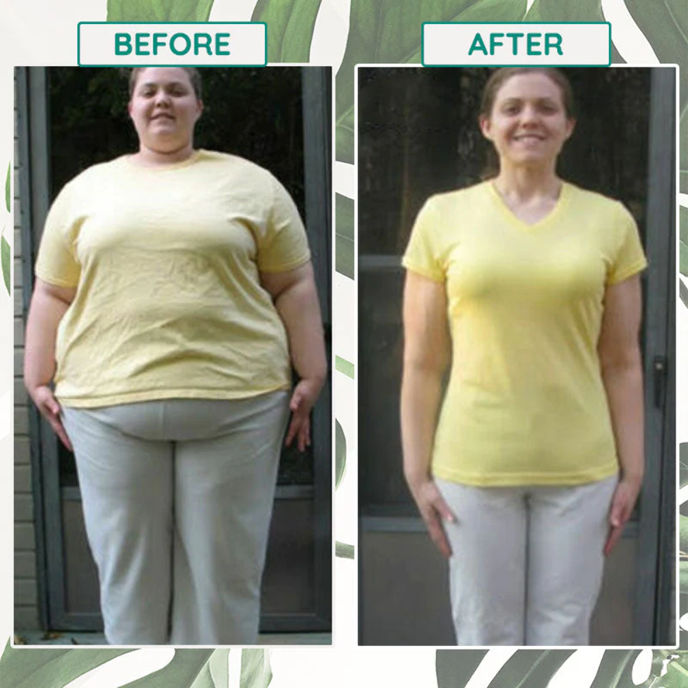 50PCS Slim Patch Weight Loss Slimming Diets Pads Detox Burn Fat Adhesive USA