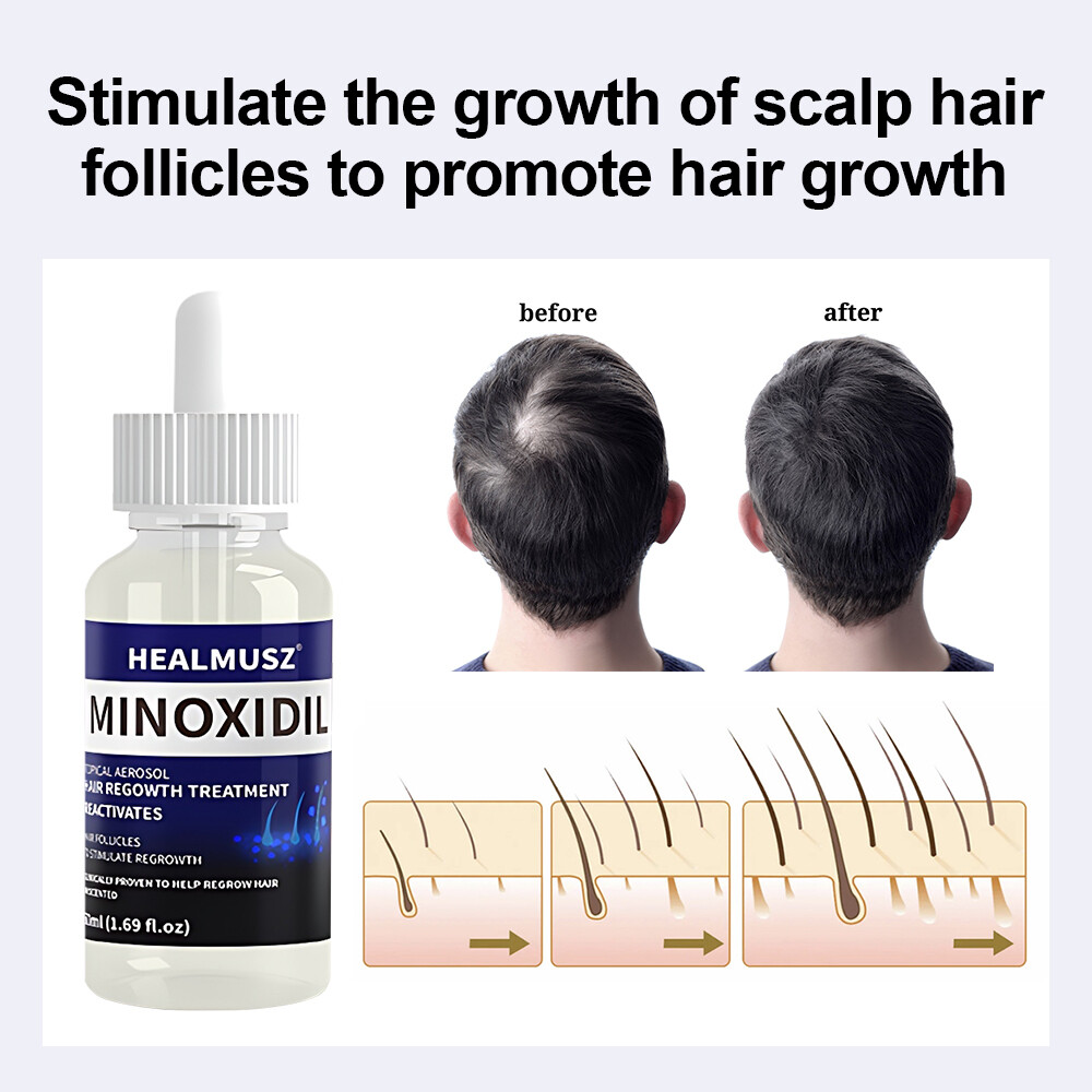 6 Pack Minoxidil 5% Extra Strength Men Hair Regrowth Treatment 6 Month Supply