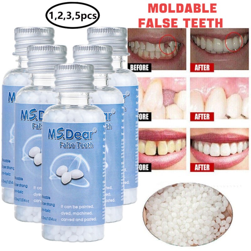 Tooth Repair Kit - Temporary Teeth Replacement Kit for Missing & Broken Teeth