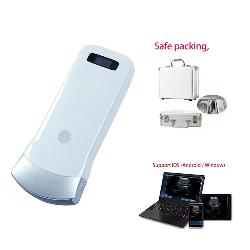 IOS Android Windows 80 Elements Convex Array Wireless Ultrasound Scanning Probe