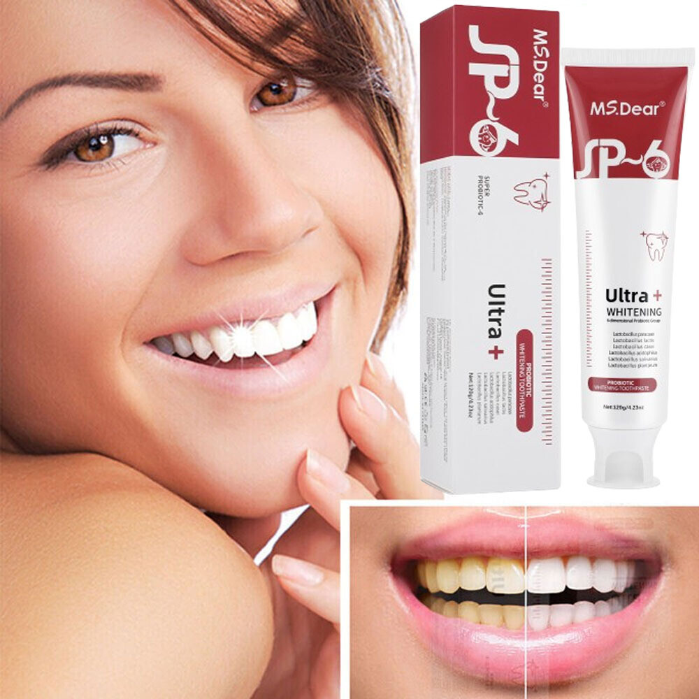 US SP-6 Probiotic Toothpaste,Sp-6 Toothpaste Whitening Quick White Toothpaste