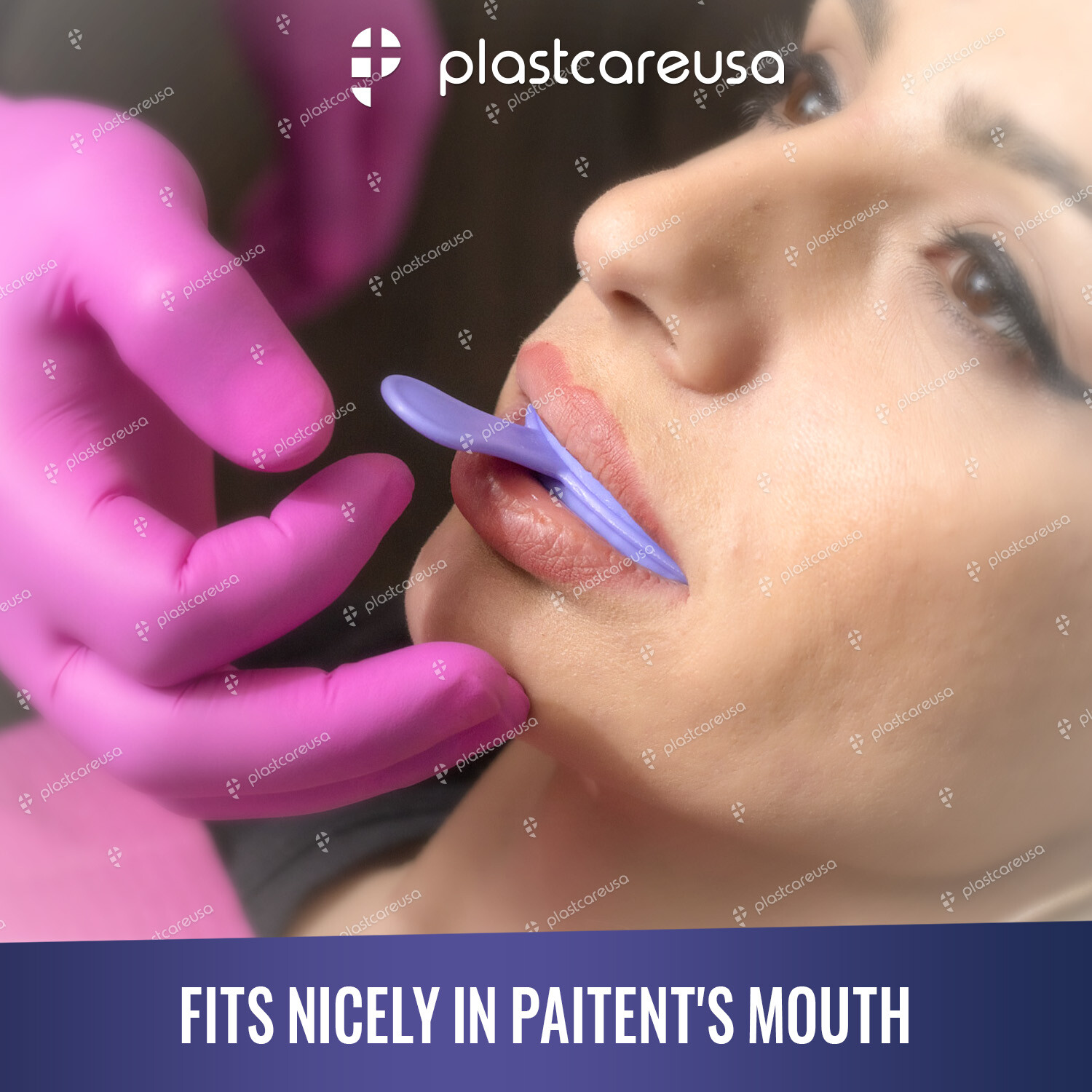 Dental Impression Bite Registration Triple Trays Mold (Choose Size & Quantity)