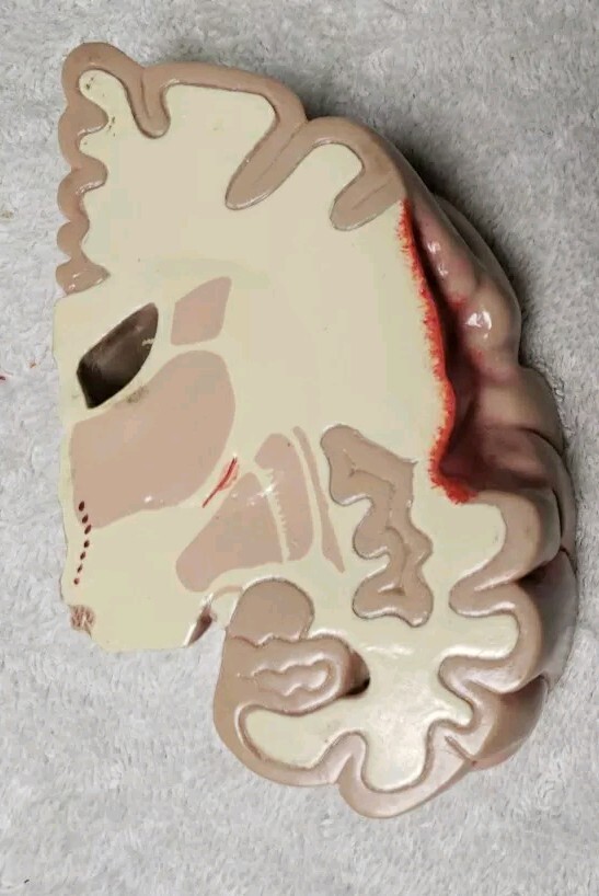 GPI Brain/ Partial Skull Model