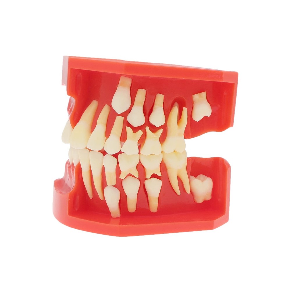 Teeth Typodonts Dental Model #7013 - Teeth Eruption Development Model Alterna...
