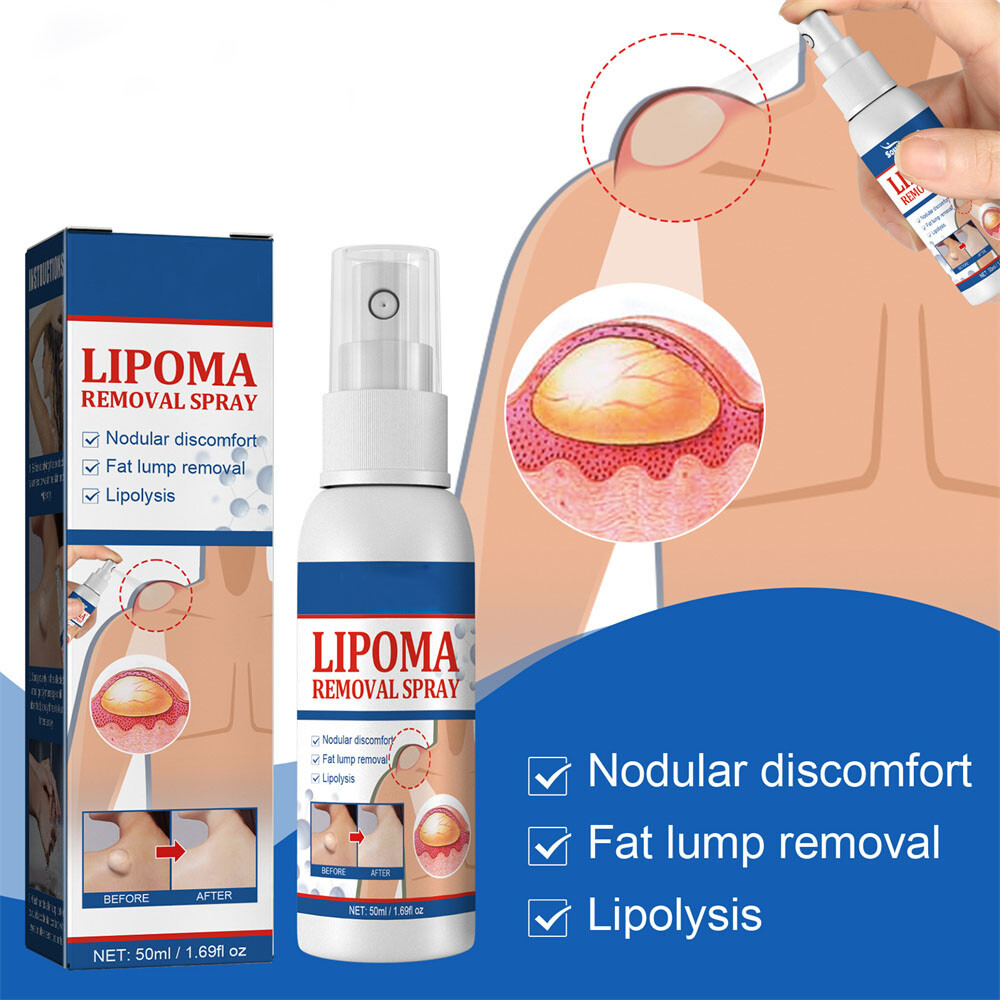 50ML Lipomheilung Reduction Spray, Instant LumpFree Lipoma Removal Spray