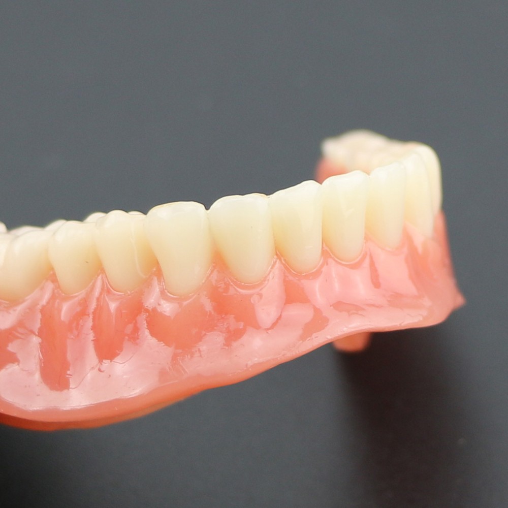 Dental Typodont Lower Teeth Demo Study Model Overdenture Inferior 4 Implants