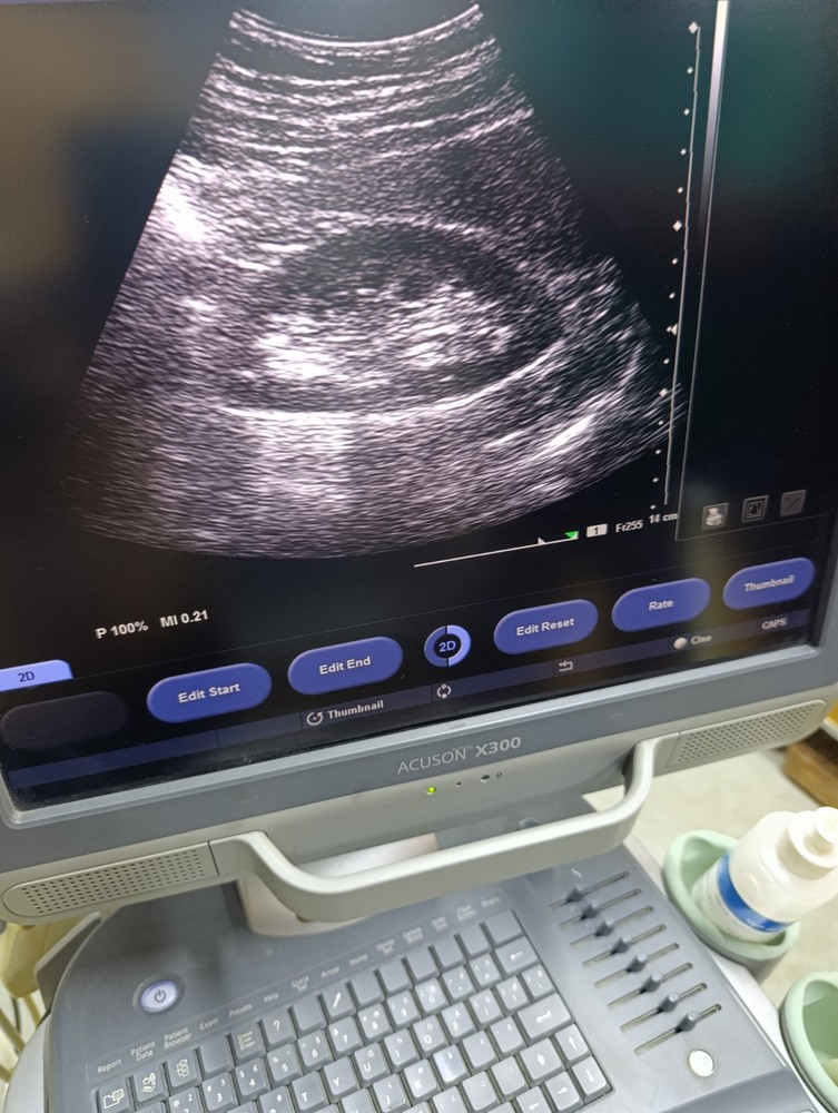 Siemens Convex Probe CH5-2