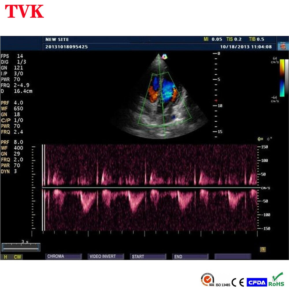 Mindray 3C5s Convex Array Ultrasound Probe Compatible M5 Abdominal Transducer