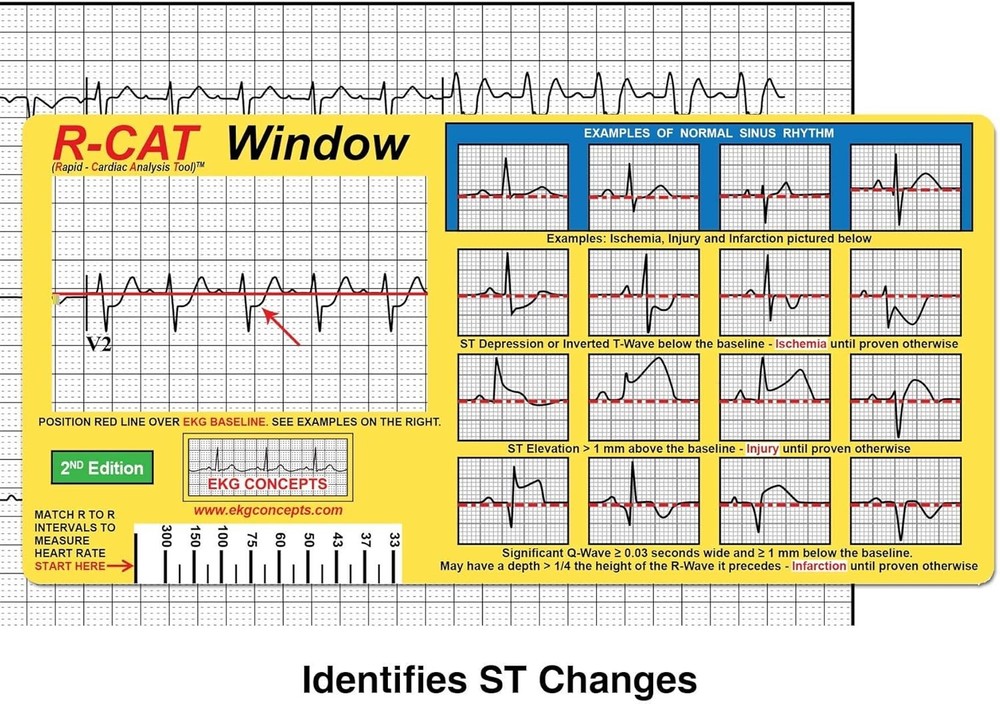 R-CAT EKG Window 2nd Edition Yellow