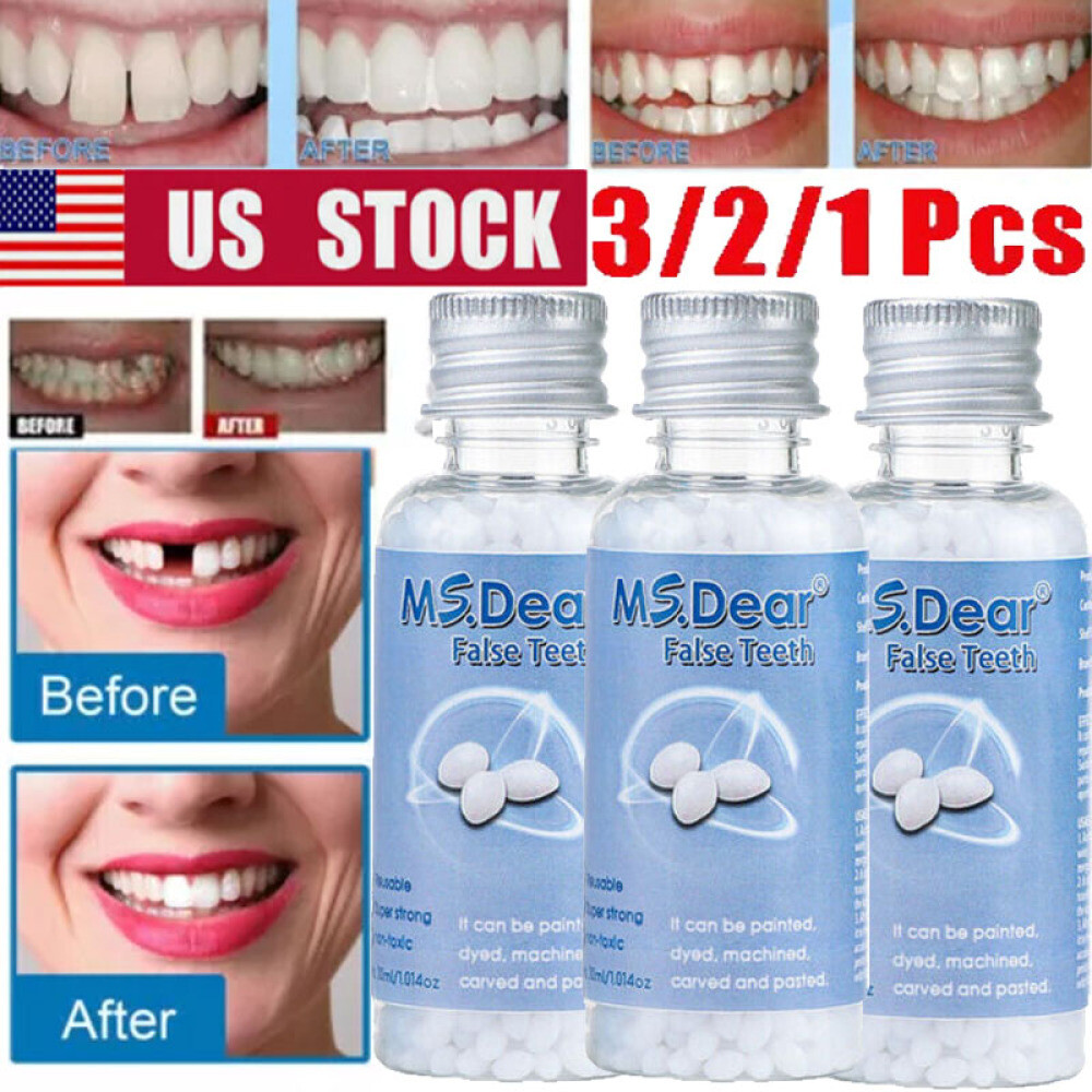 3/2Pc Tooth Repair Beads Granules,Temporary Moldable Dental Pellets, False Teeth