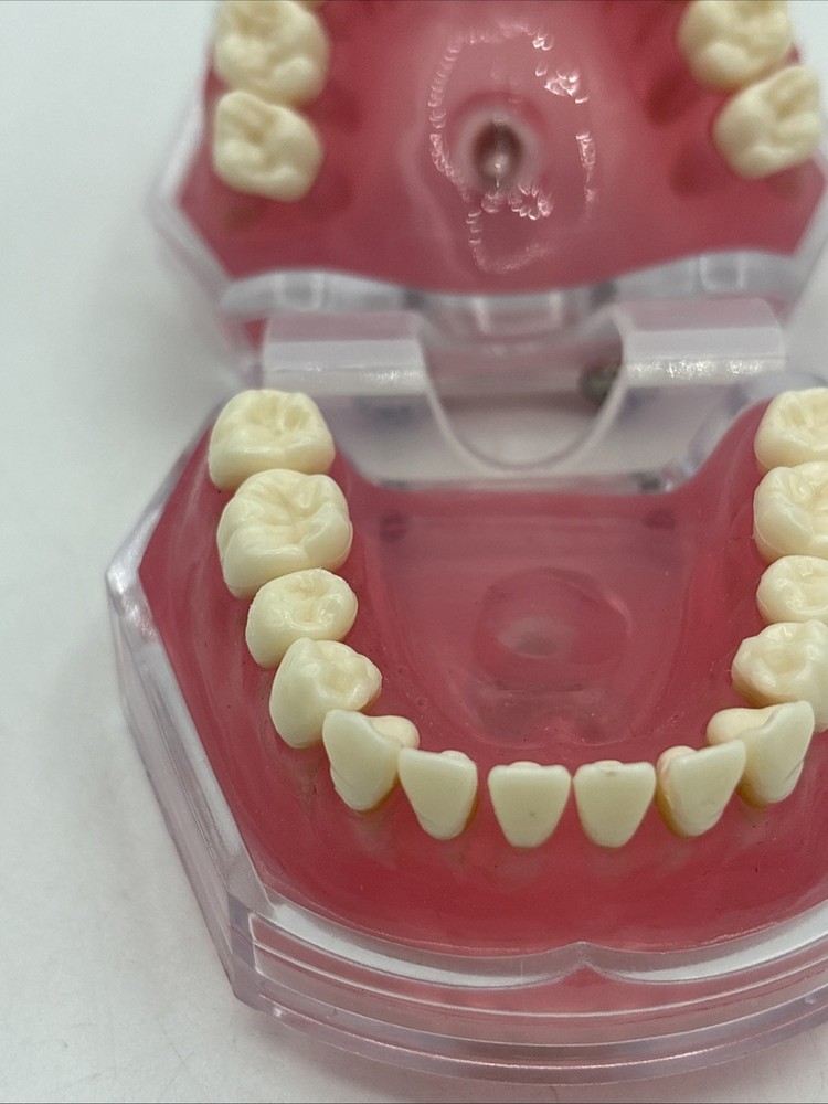 Dental Typodont Practice Removable Teeth Model M7008